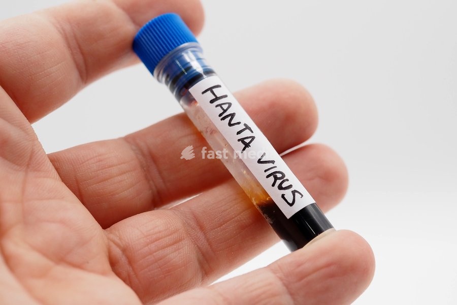 In this photo illustration, a laboratory test tube containing blood to be analyzed for the Hantavirus "Orthohantavirus" epidemic. These are RNA viruses transmitted to humans primarily by wild rodents (mice and rats)