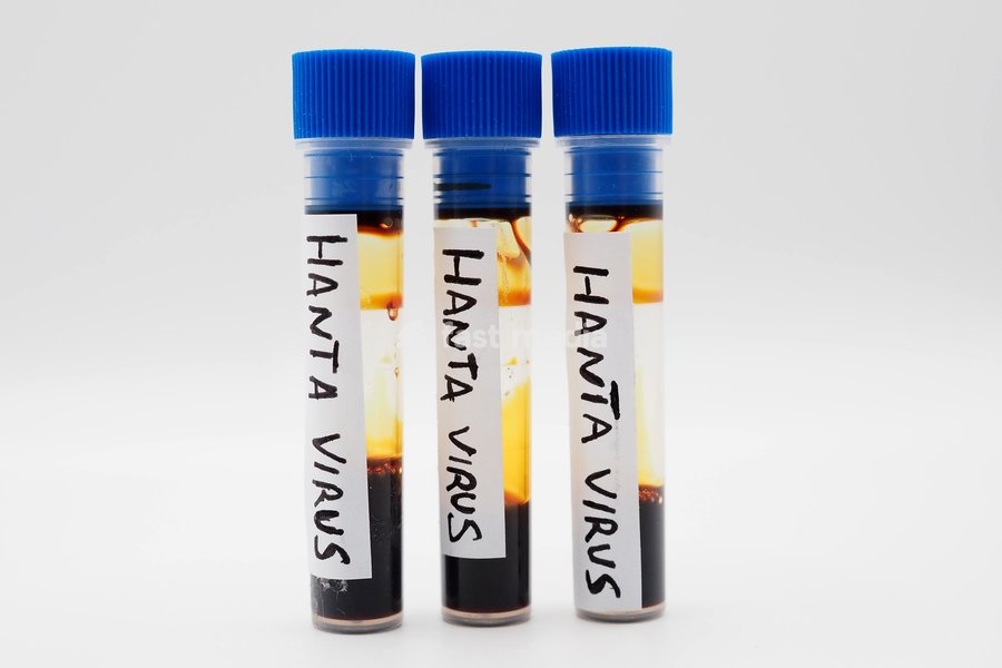 In this photo illustration, a laboratory test tubes containing blood to be analyzed for the Hantavirus "Orthohantavirus" epidemic. These are RNA viruses transmitted to humans primarily by wild rodents (mice and rats)