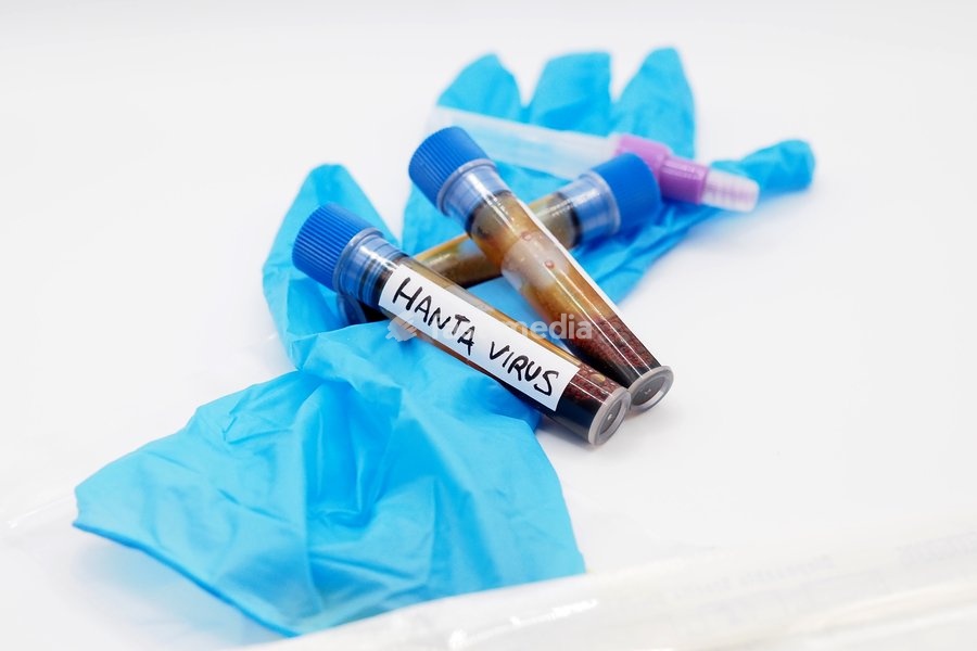 In this photo illustration, a laboratory test tubes containing blood to be analyzed for the Hantavirus "Orthohantavirus" epidemic. These are RNA viruses transmitted to humans primarily by wild rodents (mice and rats)