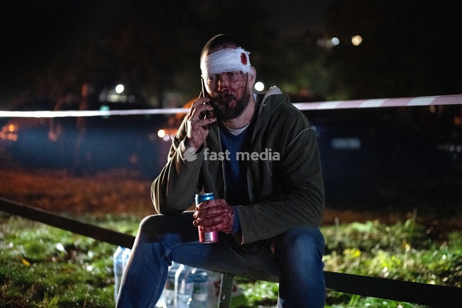 A man injured in a Russian missile strike on a nine-story residential building talks on the phone in Kyiv’s Desnianskyi district, Ukraine, on October 14, 2026. Russia launched a massive ballistic missile attack on the capital. Three women were killed and 19 people were injured in the Desnianskyi…
